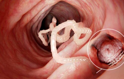 the worm is a parasite of the human body